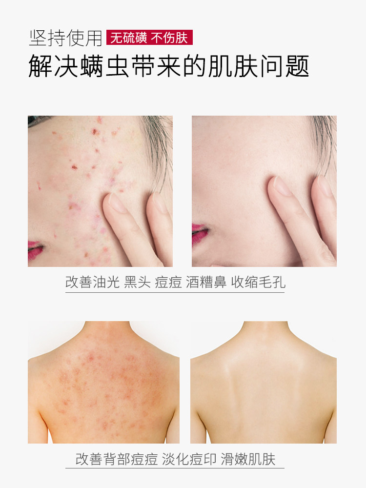  玛拉朵化妆品身体皂