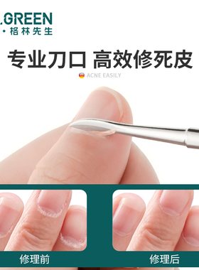 德国MR.GREEN去死皮铲刀钢推卸甲