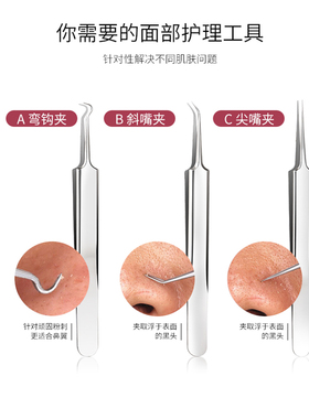 闭口黑头面部护理清洁毛孔镊子