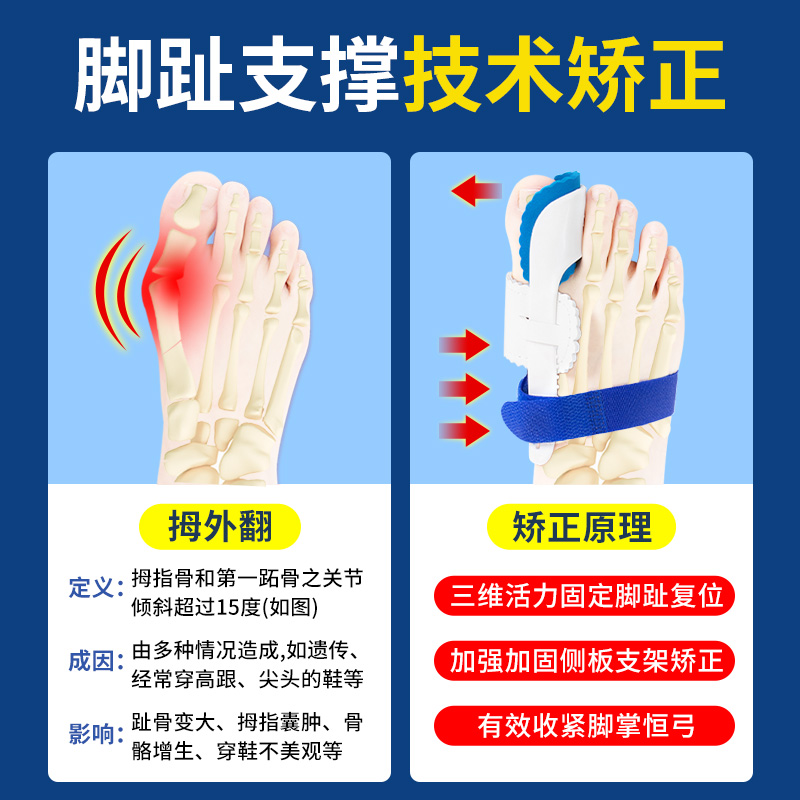 拇指外翻矫正器分大母脚趾头足改善纠正脚骨突出矫形可以穿鞋男女-图0