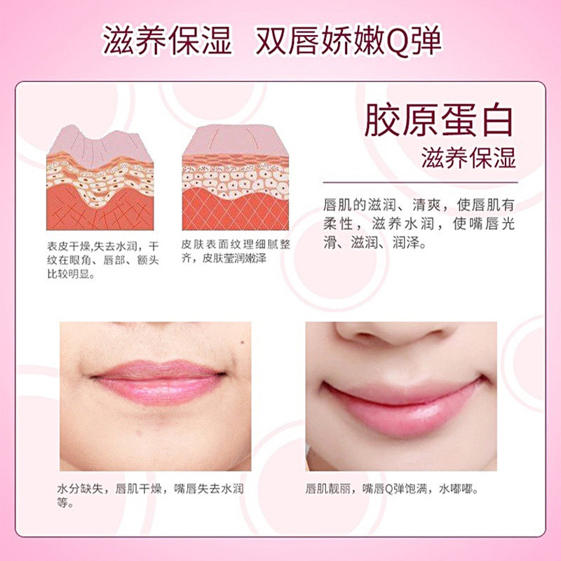  monleyta曼丽塔唇膜