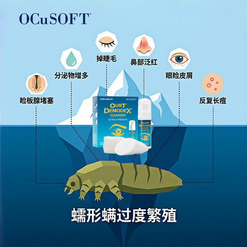 【眼部面部除螨】OCuSOFT缘螨净清洁液套装茶树精油眼睑清洁免洗 - 图1