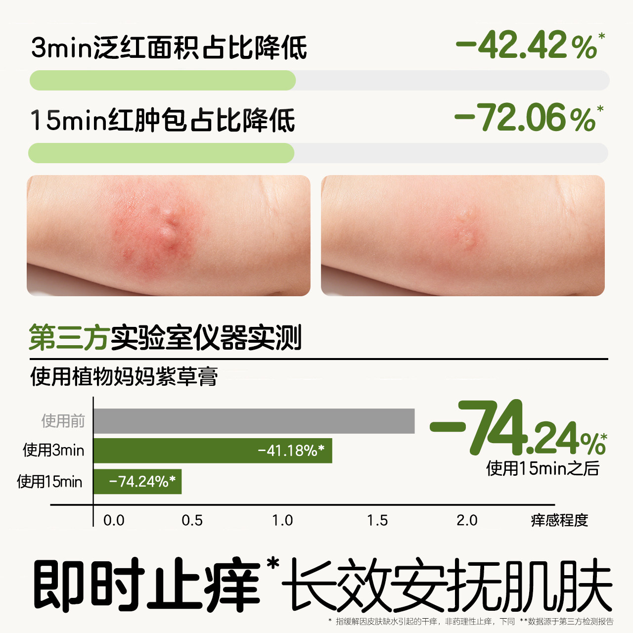 植物妈妈紫草膏婴儿专用宝宝儿童蚊子蚊虫叮咬快速止痒消包消肿膏