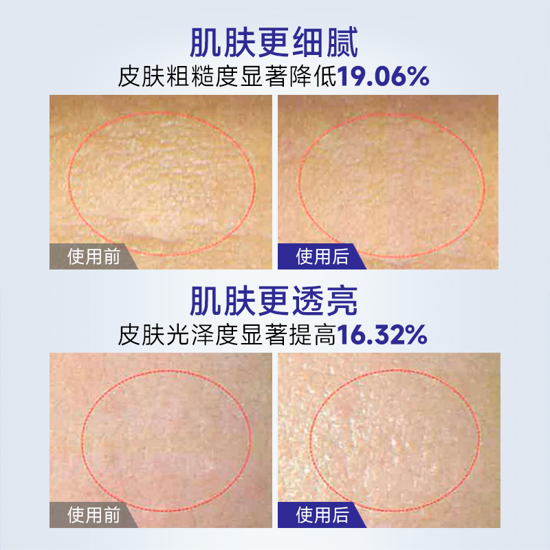 EITIKO5%烟酰胺焕亮保湿精华水补水保湿滋润