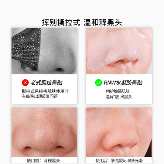rnw去黑头收缩毛孔粉刺鼻贴深层清洁男士专用神器黑白头导出液