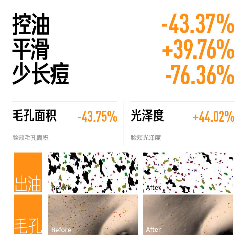 毕生之研五环水乳套装油皮精华控油祛痘收缩毛孔补水保湿油敏肌妍,淘宝优惠券,粉丝福利购,淘宝优惠卷