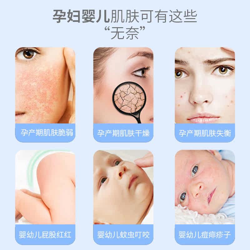 aomg /澳梦补水母婴淡印芦荟膏面霜 澳梦乳液/面霜