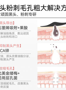 【粉刺针秒去黑头】哈恩果酸鼻贴