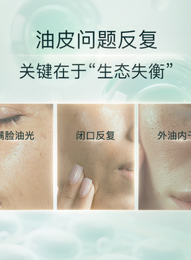 玛莉格控油净痘油皮保湿护肤礼盒