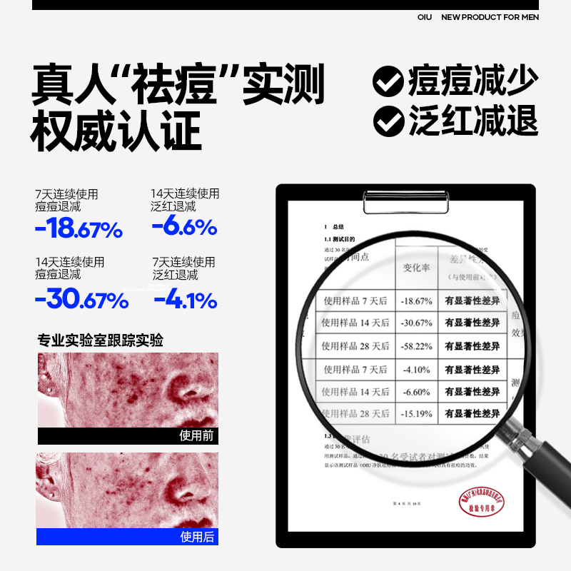 oiu男士祛痘护肤套装去闭口淡痘印敏感肌可用控油改善油痘肌泛红 - 图3