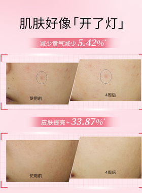 凌博士美白特证精华水敏肌可用