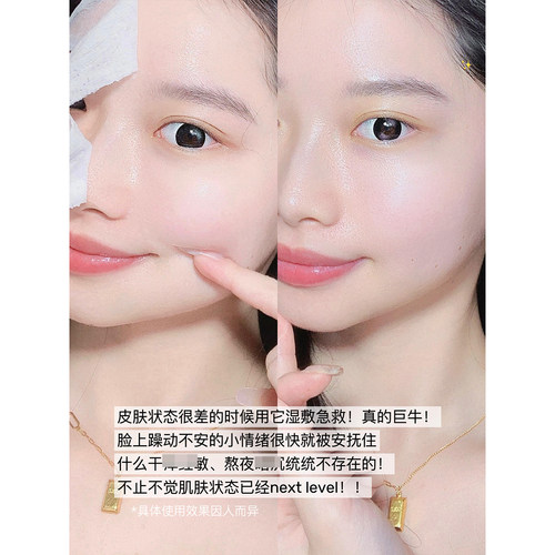 修护界高手！ddg511焕采精华清爽版滋润版保湿修护舒缓缓b5精华水 - 图2