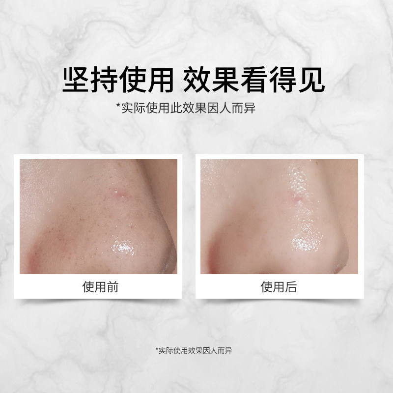 马鞭草酮迷迭香马迷纯露堵塞爽肤水 绿茶花纯露/花水