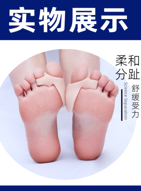 儿童专用脚趾矫正器拇指外翻分趾器宝宝专用足外翻分离可穿鞋