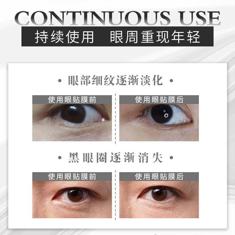 by biotic保湿补水黑眼圈眼贴膜 bybiotic眼膜