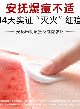 茂美祛痘霜30g专注青少年痘痘