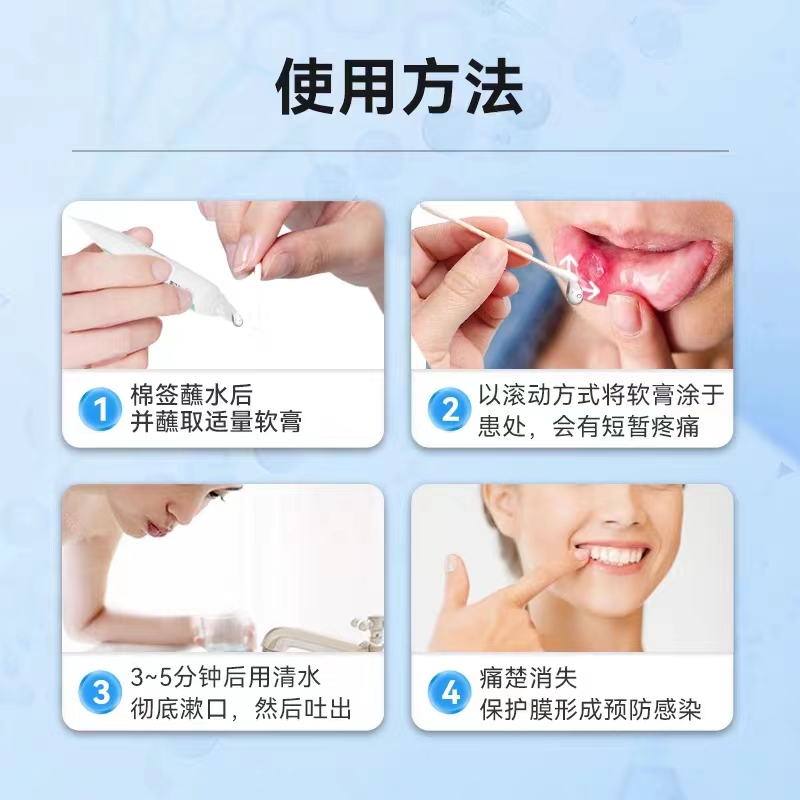 妥能药业口腔溃疡凝胶缓解口腔溃疡上火起泡疼痛药房旗舰正品9zz - 图2