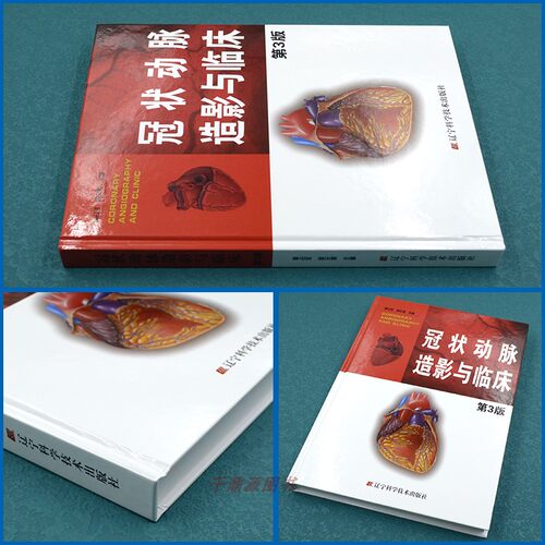 正版书籍  冠状动脉造影与临床 第3版  李占全金元哲 冠脉造影介入心脏病学心血管内外科医师冠状动脉造影医学书籍 辽宁科技出版社 - 图0
