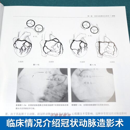 正版书籍  冠状动脉造影与临床 第3版  李占全金元哲 冠脉造影介入心脏病学心血管内外科医师冠状动脉造影医学书籍 辽宁科技出版社 - 图2