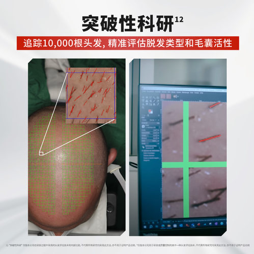 【欧倍青】Alpecin DMG洗发水德国进口咖啡因强韧控油蓬松丰盈 - 图1