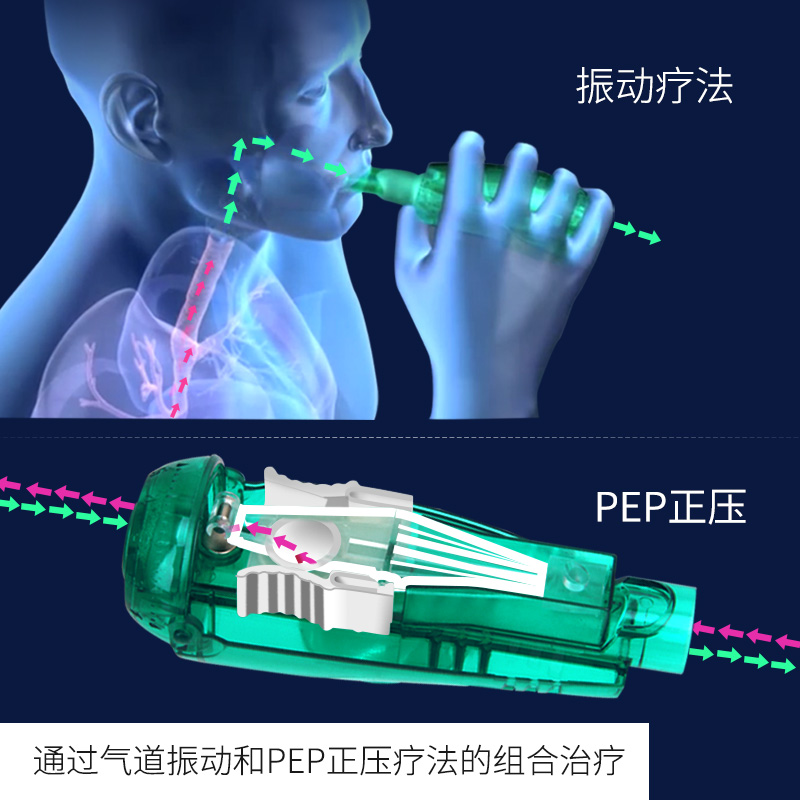 Acapella振动正压通气治疗系统排痰神器老人慢阻肺功能呼吸训练器-图0