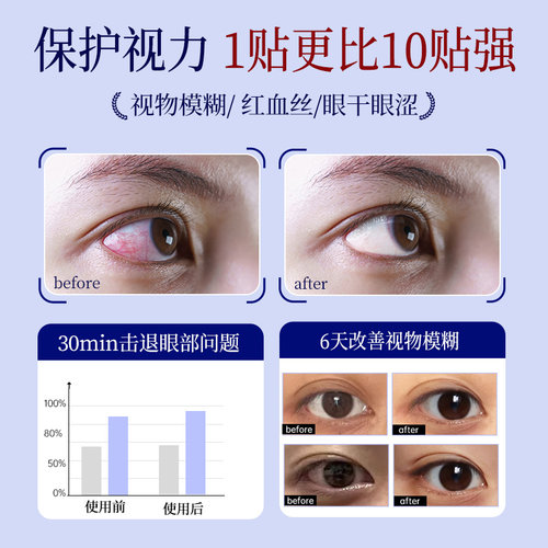 茶树精油除螨湿巾眼睛眼贴眼部螨虫4-松油醇专用眼睑清洁眼 - 图3