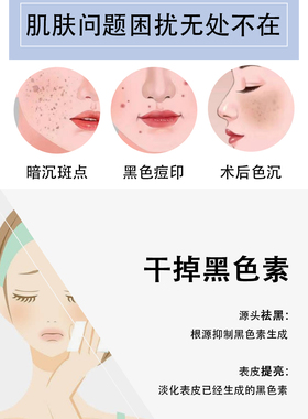 1%传明酸湿敷液淡斑退黑改善暗沉