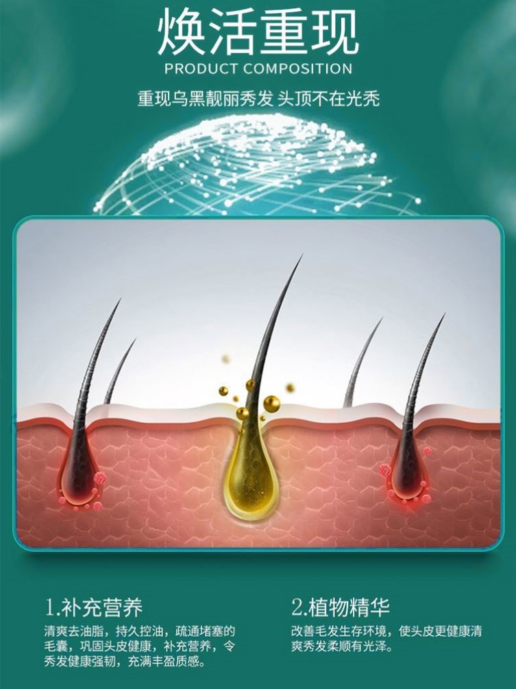 头皮干燥起皮补水喷雾保湿止痒滋养头皮屑多润发根护理毛囊营养液 - 图0