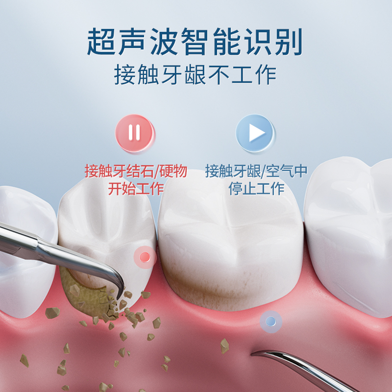 同诗超声波洁牙仪 配件洁牙五件套 适配型号J1 - 图2