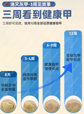 灰指甲光疗机紫外线真菌感染清洁