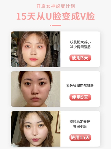 [Вейя рекомендует артефакт V лица] Big Face Kesta может использоваться в секундах для изменения семян дыни.