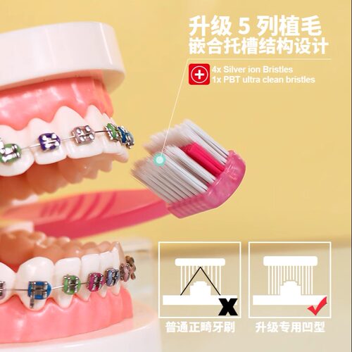 正畸专用牙刷德国软毛牙套牙箍清洁凹型矫正齿抗菌银离子手动牙间 - 图1