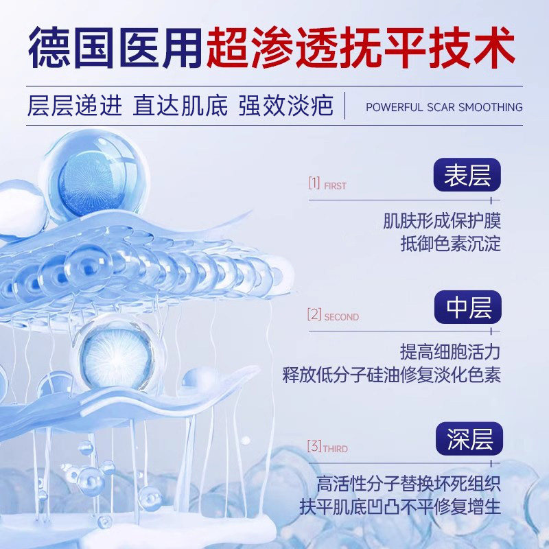 【三甲医用】那复达疤痕贴医用硅酮敷料剖腹产印增生修复除祛疤