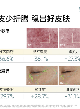 安润小粉瓶精华液2.0淡纹舒缓