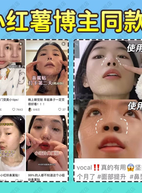 张予曦同款小哑铃缩小鼻翼弹力贴