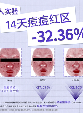 艾酸氏五酸洁面乳 1%水杨酸果酸青少年抗痘氨基酸油痘肌洗面奶
