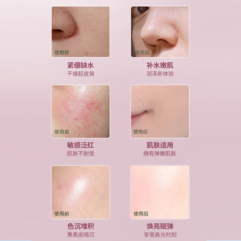 8+Minute新西兰8分钟山羊奶皮滋养面膜八分钟补水舒缓面膜10片/盒