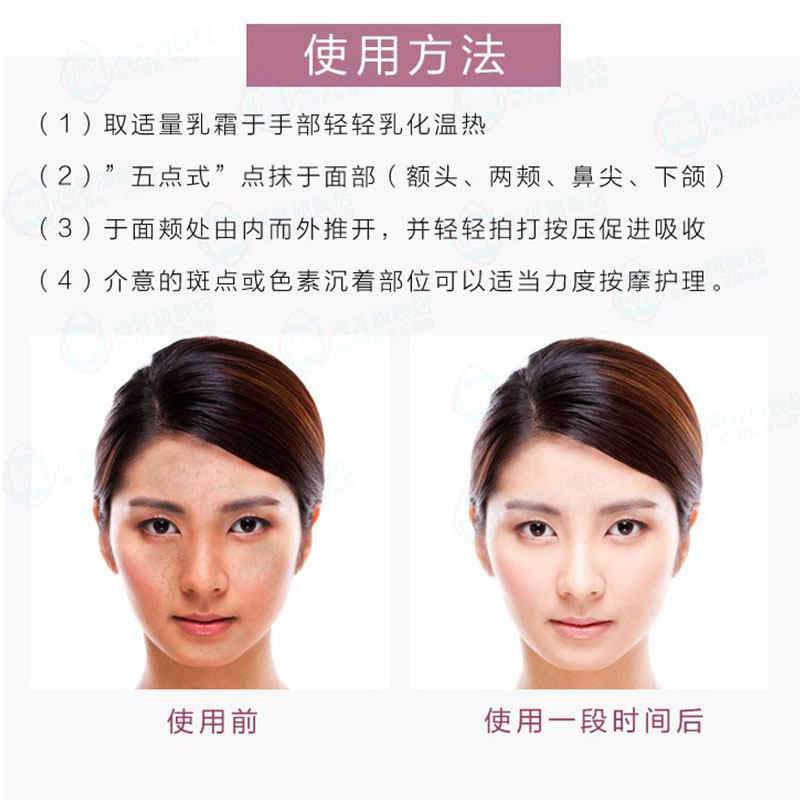 日本正品祛斑美白黄褐斑日晒斑面霜 ONWAY海外乳液/面霜