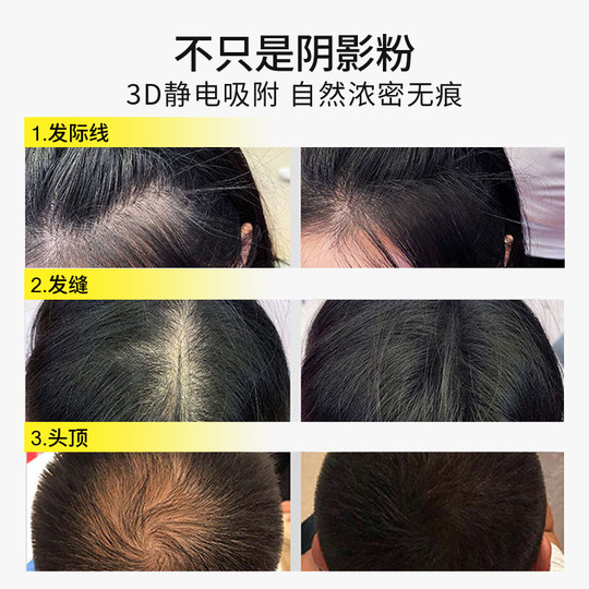 【电动新品】头发纤维粉增发补发缝密发量增多发际线头顶稀疏假发