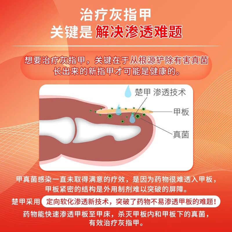  百姓弘发大药房癣症