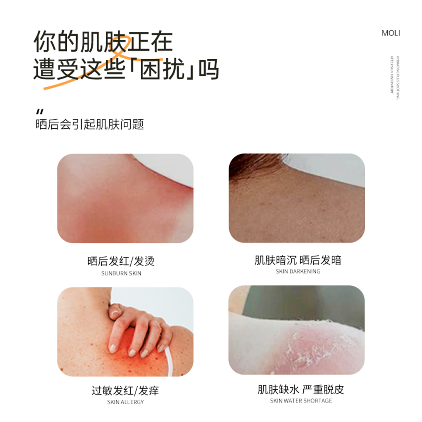 百肤邦晒伤修护膏晒后修护喷雾户外运动军训皮肤泛红改善脱皮喷雾