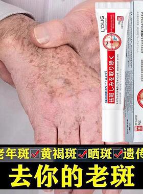 专去斑霜治祛老年斑专用脸部去手上手部手背的药膏祛黄褐斑正品
