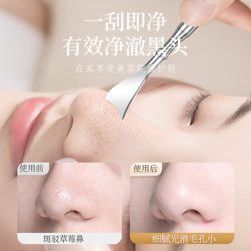 黑头铲死皮黑头刮脂挤痘痘棒暗疮针粉刺针美容院毛囊清洁手动神器,淘宝优惠券,粉丝福利购,淘宝优惠卷
