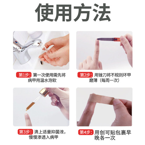 云南本草灰指甲专用抑菌液增厚抑菌液便捷真菌感染软甲脱甲膏2送1 - 图2
