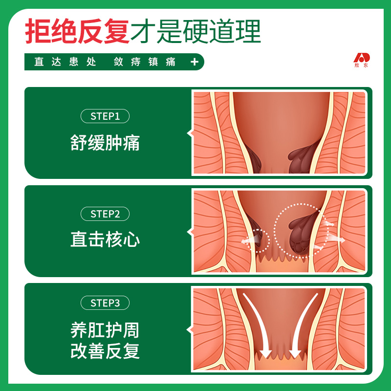 敖东医用敷料痔疮凝胶痔疮膏内外痔肛门肉球瘙痒断痔膏正品JNXL