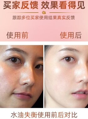 精华油纯植物玫瑰提拉紧致拍1发5