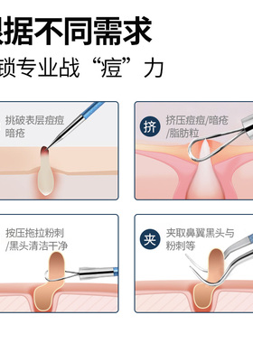专业粉刺针细胞夹黑头套装