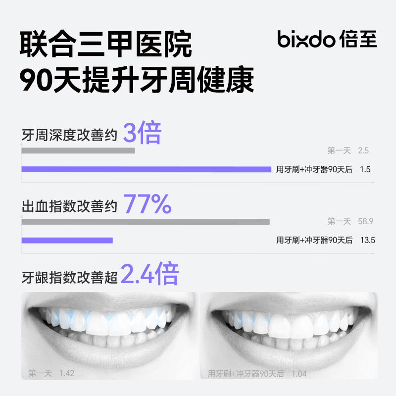 倍至小温泉冲牙器家用洗牙器台式