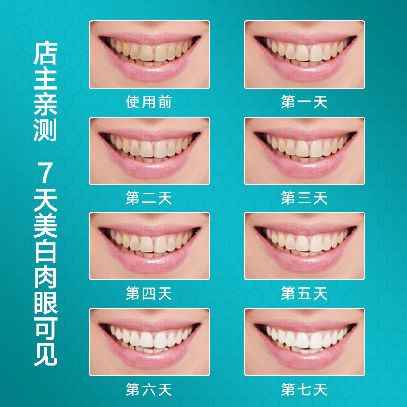 wildwood唯悟速白美白神器14对牙贴 wildwood牙齿美白脱色剂