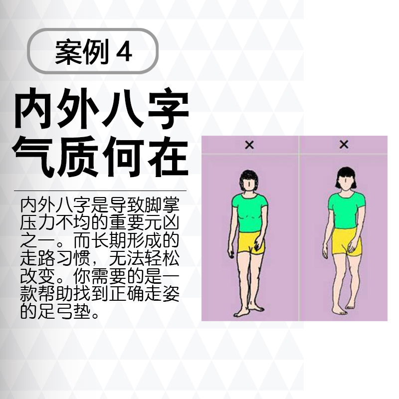 奇魔师日本扁平足鞋垫x型o型腿足底小腿足外翻高足弓垫支撑儿童器 - 图2